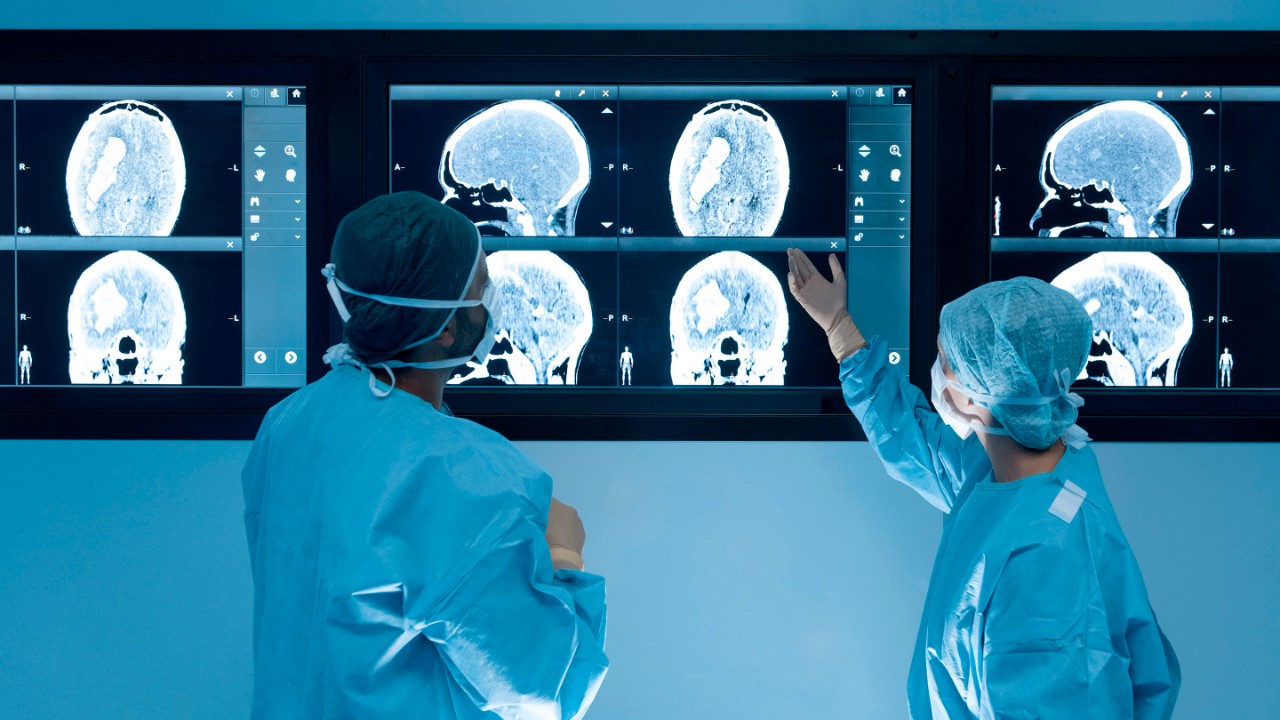 Surgeons looking at magnetic resonance imaging (MRI) brain scans during brain surgery.