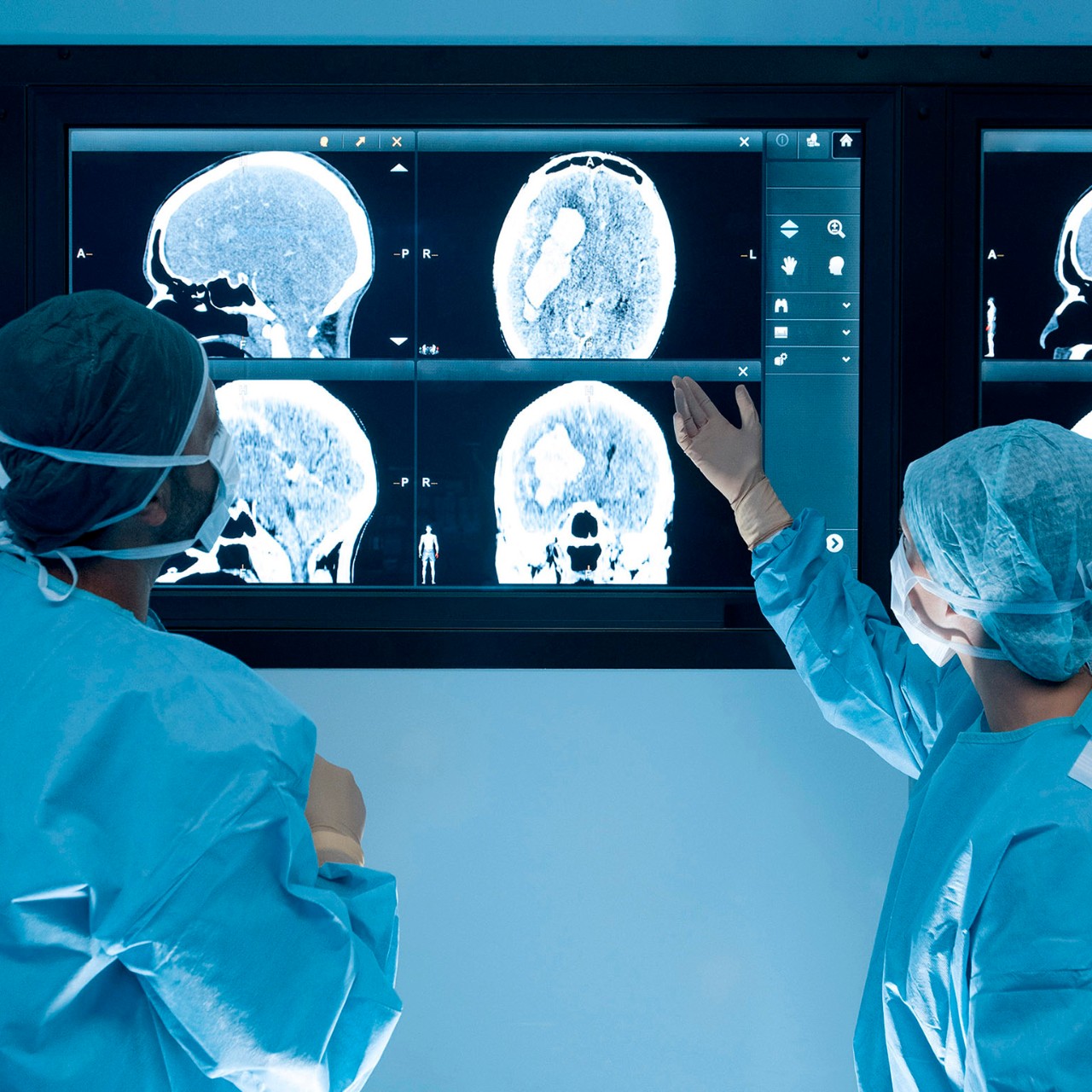 Surgeons looking at magnetic resonance imaging (MRI) brain scans during brain surgery.